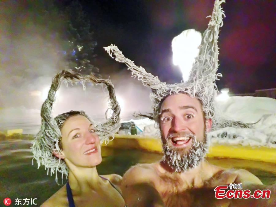 Crazy hair freezing contest in Canada