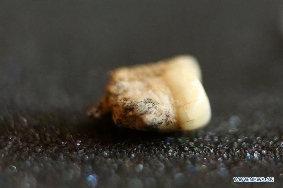 <?php echo strip_tags(addslashes(A premolar tooth is seen as part of the set of fossils of a newly discovered human species called Homo luzonensis at the University of the Philippines in Quezon City, the Philippines, April 11, 2019. Found in Callao Cave on Luzon Island, the 50,000-year-old remains belong to a now extinct species of human. (Xinhua/Rouelle Umali))) ?>