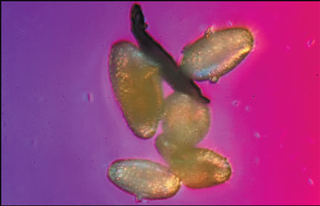 A picture of smog particles under the microscope taken by Zhang Chao