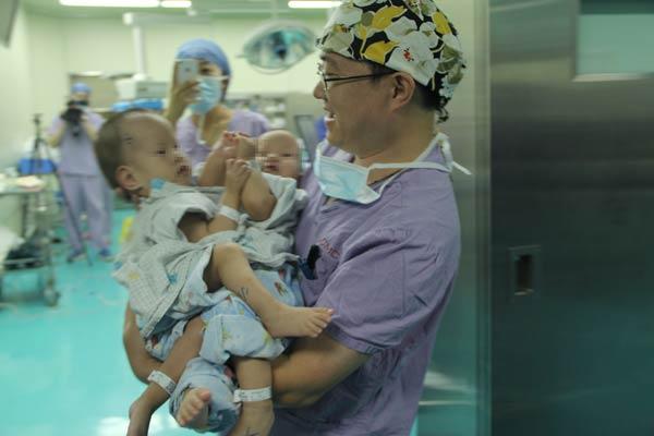 A doctor holds the conjoined twins before an operation to separate the sisters on Wednesday, July 16, 2014. [Photo provided to chinadaily.com.cn]
