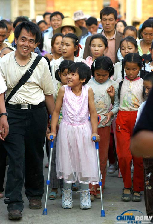 Qian received her first artificial limbs in May, 2005. [Photo/chinadaily.com.cn]