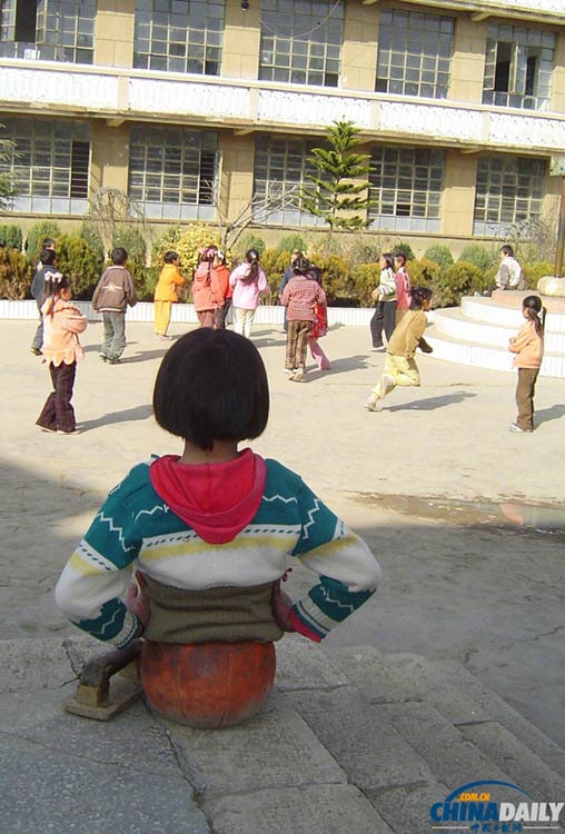 Qian watches other children play while having half a basketball under her waist, January, 2005. [Photo/chinadaily.com.cn]  