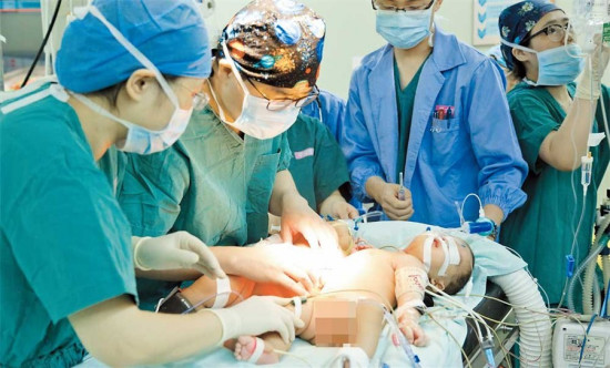 Surgeons operate on the conjoined twin girls yesterday at the Childrens Hospital of Fudan University. The 3-month old twins were connected by liver and stomach at birth. (Photo/Ti Gong)